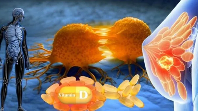 Официальное исследование подтверждает, что витамин D борется со всеми формами рака