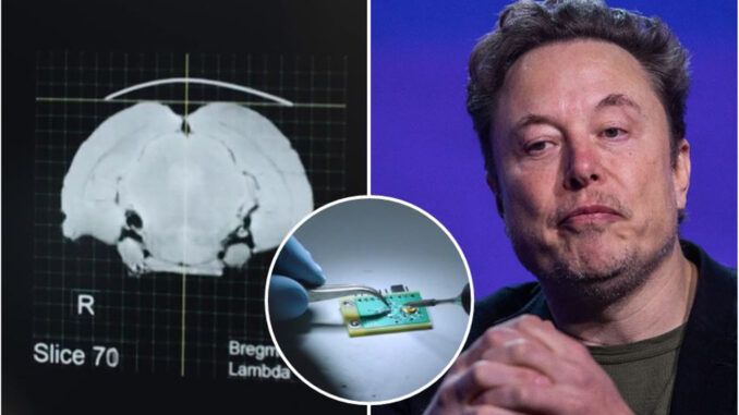 Neuralinkg Elon Musk
