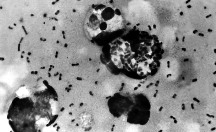 CDC Warns of ‘Imminent’ Plague Pandemic